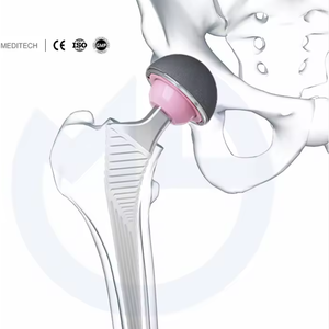 Full Set Femoral stem Acetabular Cup Hip Prosthesis