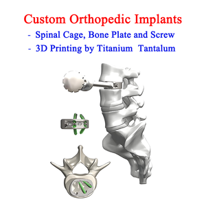 Custom High Precision 3D Printing Service Titanium Implants