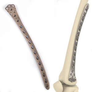 CANWELL Distal Lateral Femoral Titanium Locking Plate Compression Orthopedic Femur Implants Trauma Fracture Surgery CE ISO Class