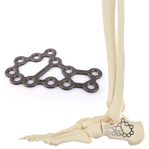 CANWELL Medical Calcaneal Locking Plate Titanium Foot Heel Bone Implants