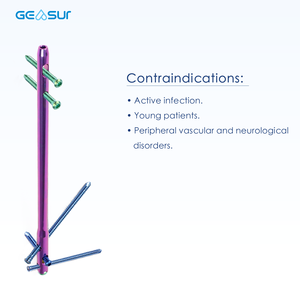 CE ISO Approved Titanium Hindfoot Ankle Intramedullary Nail for Foot Ankle Fracture Orthopedic Trauma Surgery
