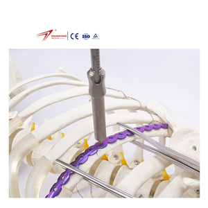 Shuangyang Medical Custom Titanium Rib Bone Plate Implants