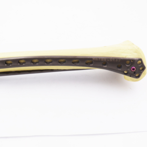 Titanium Distal Femur Locking Plate Orthopedic Implants